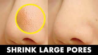 5STEP Dermatologist's Tip to Shrink Large Pores