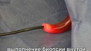 Обучение гистероскопии. Наглядно и интересно.