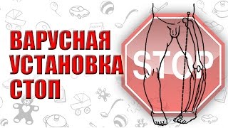 ВАРУСНАЯ УСТАНОВКА СТОП. ВАРУСНАЯ ДЕФОРМАЦИЯ НИЖНИХ КОНЕЧНОСТЕЙ