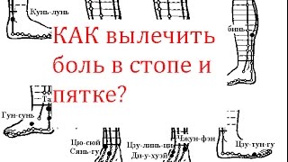 Как вылечить боль в стопе и пятке?
