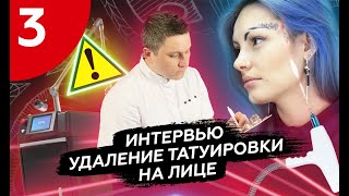 удаление татуировки на лице #удалениетату #татуналице
