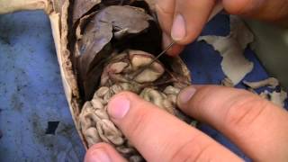 Sam's Internal Examination 1
