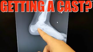 ORTHOPEDICS DOCTOR APPOINTMENT! GETTING A CAST? EMMA AND ELLIE