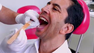 SomnoGuard® 3 von TOMED - Anpassungsvideo der Anti-Schnarchschiene