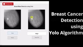 Breast Cancer Detection using Yolo Algorithm