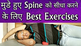 Best SCOLIOSIS Exercises - Exercises To Correct Scoliosis Completely At Home - Scoliosis Treatment