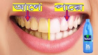 মাত্র ৩০ সেকেন্ডে কালো ও হলদে দাঁত উজ্জ্বল ও সাদা করার উপায় | আপনার দাঁত লাইটের মতো ঝকঝকে হয়ে যাবে