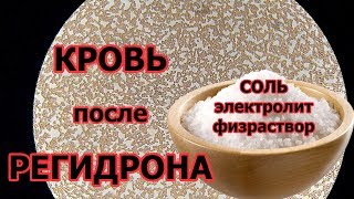 Кровь после регидрона