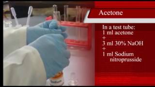 Na nitroprusside test