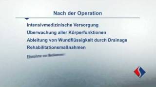 Rekonstruktion und Ersatz der Aortenklappe Teil 8 - Nach der Operation