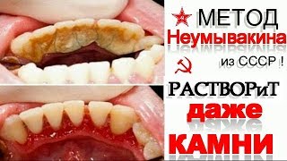 СЕКРЕТНЫЙ Рецепт Отбеливания и Лечения ЗУБОВ по Неумывакину - в домашних условиях