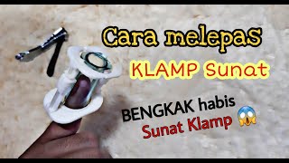 Cara Melepas Klamp Sunat
