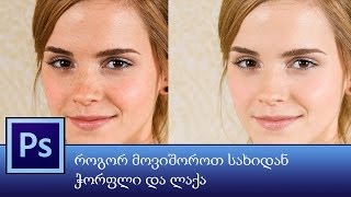 როგორ მოვაშოროთ სახიდან ჭორფლი, ზედმეტი ნაოჭი ან ლაქა -  How to remove blemishes in Photoshop