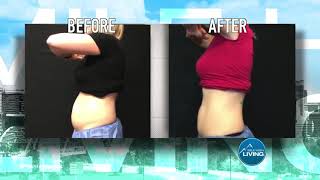 Hollywood Body Laser Center: Call for a Free Consultation