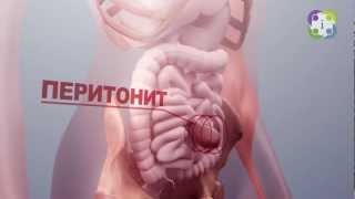 МЕД-инфо. Грыжа: причины, симптомы и скрытые опасности