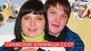 Сиамские близнецы, удачно разделенные в СССР