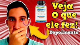 ?Actane Depoimento SINCERO! Actane Funciona Mesmo? Actane Resenha Actane