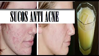 SUCO CASEIRO QUE ACABA COM ESPINHAS\ACNE-Resultado Incrível em Poucos dias