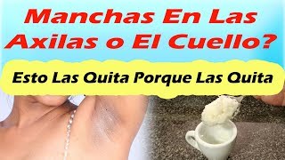 Como Quitar Las Manchas De Las Axilas y Manchas Oscuras En El Cuello COMO ACLARAR LAS AXILAS
