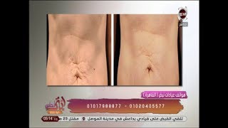 طرق علاج مشاكل الجسم المختلفة - د.ماريان نادر | انتي احلى