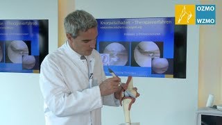Prof. Dr. Diehl: Knorpelglättung bei fortgeschrittenem Knorpelschaden