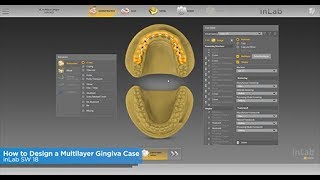 inLab SW 18: How to Design a Multilayer Gingiva Case