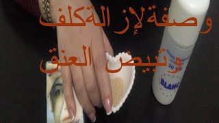 ?تجربتي  في تبيض الرقبة  وإزالة كلف قديم غدي تصدمكوم نتيجه ? ? ??