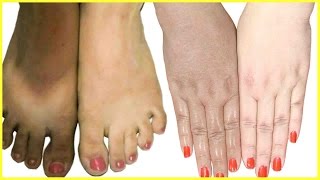Body Whitening & Polishing Home Remedy | Lighten Dark Body Parts, Hands, Feet, Dark Knees & Elbows