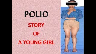 Polio story of a young girl