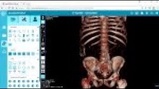 Viewing in 3D - postDICOM Free DICOM Viewer