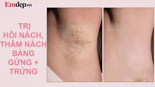 Công thức TRỊ DỨT ĐIỂM HÔI NÁCH, THÂM NÁCH chỉ bằng trứng gà và gừng