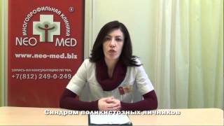 Синдром поликистозных яичников