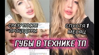МОЙ ОПЫТ УВЕЛИЧЕНИЯ ГУБ В ТЕХНИКЕ ТП