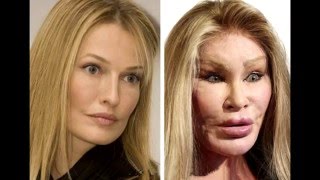 Жертвы пластической хирургии  The victims of plastic surgery