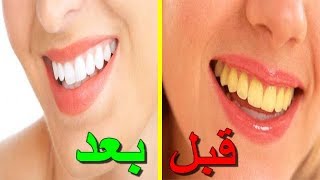 5 طرق منزلية للحصول على أسنان بيضاء ناصعة ⭐⭐