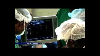 Doctors in Zimbabwe have successfully separated conjoined twins