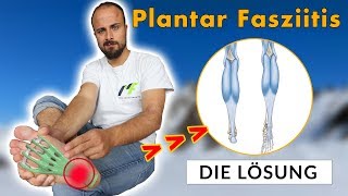 So wirst du Plantar Fasziitis los (Nie wieder Schmerzen an der Ferse)