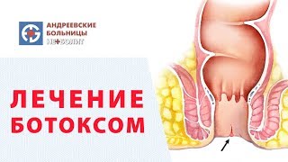 ?  Новейший метод лечения трещин заднего прохода. Трещина заднего прохода лечение. Неболит. 12+