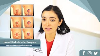 Breast Reduction Techniques