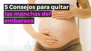 Consejos para quitar las manchas del embarazo?¿Cómo prevenir y eliminar las manchas en el embarazo?