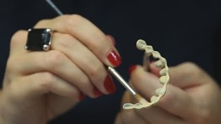Bridge dentaire [création] - Endurance Implant Hongrie