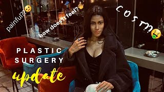 My breast augmentation post op. Part 2