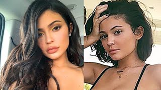 Kylie Jenner Admits She Removed Her Lip Filler