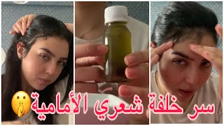 وصفة لخلفة الشعر و مَلْأ الفراغات| baby hair ?
