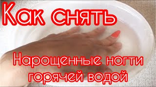 Как снять НАРОЩЕННЫЕ НОГТИ ГОРЯЧЕЙ ВОДОЙ в Домашних условиях