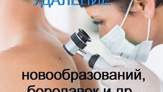 Удаление новообразований в клинике "BL"
