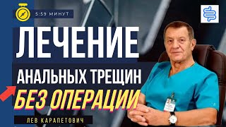 Лечение анальной трещины без операции (безоперационные методы лечения)