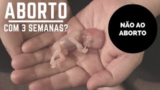 Aborto com 3 semanas? STF Legaliza o aborto - Diga não! - Feto se mexendo - O Fluxo da Vida