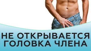 Не открывается головка члена