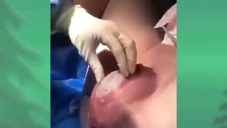 Normal hospital birth giving birth at the hospital